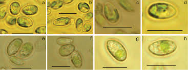 Attēlu rezultāti vaicājumam “Plectocarpon lichenum”