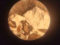 Attēlu rezultāti vaicājumam “Diderma effusum spores”