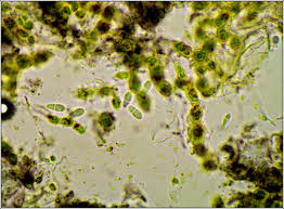 Attēlu rezultāti vaicājumam “Arthonia spadicea”