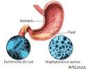 Food Poisoning :: Nationwide Children's Hospital