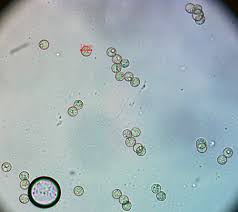 Attēlu rezultāti vaicājumam “Heterotrichia obvelata (syn. Arcyria obvelata) young”