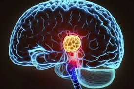 Image result for przyk adnica