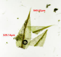 Attēlu rezultāti vaicājumam “Bryum pallens sporophyte”