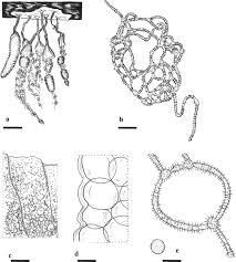 Attēlu rezultāti vaicājumam “Arcyria imperialis stalked”