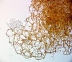 Attēlu rezultāti vaicājumam “Cribraria costata spores”