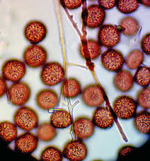 Attēlu rezultāti vaicājumam “Lycogala ustulatum sessile”