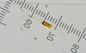 Attēlu rezultāti vaicājumam “Lycogala alisaulianovae sessile”