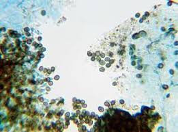 Attēlu rezultāti vaicājumam “Lichenoconium xanthoriae”