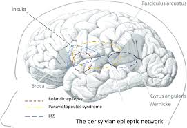 Attēlu rezultāti vaicājumam “Perichaena corticalis sessile”