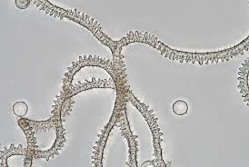 Attēlu rezultāti vaicājumam “Arcyria minuta stalked”