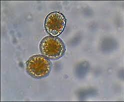 Attēlu rezultāti vaicājumam “Puccinia agrostidis”