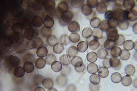 Attēlu rezultāti vaicājumam “Diderma effusum young”