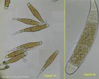 Attēlu rezultāti vaicājumam “Bactridium flavum”