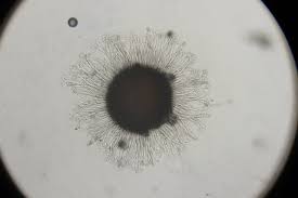 Attēlu rezultāti vaicājumam “Sawadaea tulasnei”