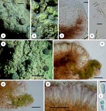 Attēlu rezultāti vaicājumam “Arthonia byssacea”