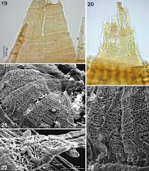 Attēlu rezultāti vaicājumam “Orthotrichum speciosum sporophyte”