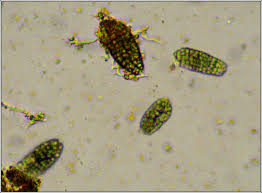 Attēlu rezultāti vaicājumam “Phlyctis agelaea”