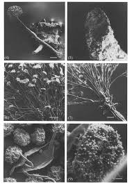 Attēlu rezultāti vaicājumam “Clastoderma debaryanum spores”