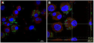 Attēlu rezultāti vaicājumam “Leiocolea rutheana cells”