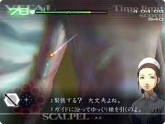 「月森孝介 超執刀 カドゥケウス」の画像検索結果