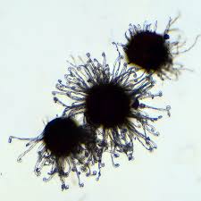 Attēlu rezultāti vaicājumam “Sawadaea tulasnei”