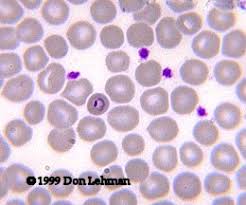 Attēlu rezultāti vaicājumam “Enteridium variabile plasmodium”