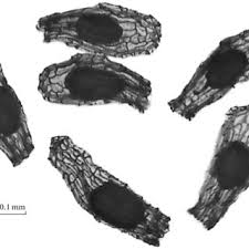 Attēlu rezultāti vaicājumam “Gymnadenia conopsea fruit”