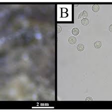 Attēlu rezultāti vaicājumam “Oligonema flavidum spores”