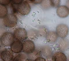 Attēlu rezultāti vaicājumam “Didymium verrucisporum macro”