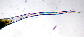 Attēlu rezultāti vaicājumam “Grimmia pulvinata sporophyte”