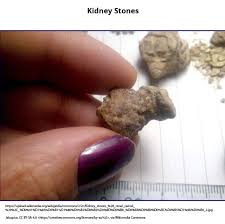 Image result for %D0%B6%D0