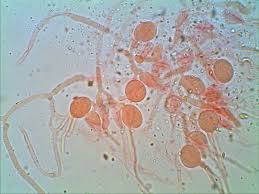 Attēlu rezultāti vaicājumam “Craterocolla cerasi”