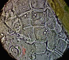 Attēlu rezultāti vaicājumam “Octospora splachnophila spores”