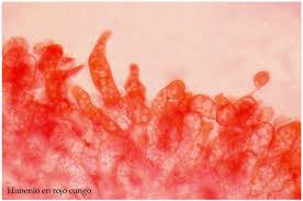 Attēlu rezultāti vaicājumam “Rimbachia neckerae”