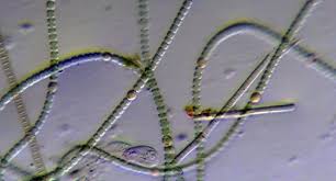 Attēlu rezultāti vaicājumam “Nostoc commune macro”