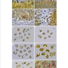 Attēlu rezultāti vaicājumam “Trichia longipalpis spores”