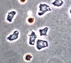 Attēlu rezultāti vaicājumam “Diderma testaceum spores”