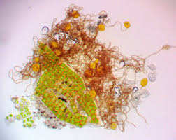 Attēlu rezultāti vaicājumam “Trichiaceae, Hemitrichiaceae, Arcyriaceae”