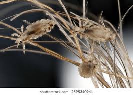 Attēlu rezultāti vaicājumam “Pediculus humanus capitis”