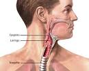 O cancro da <b>laringe</b>