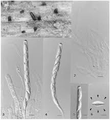 Attēlu rezultāti vaicājumam “Ombrophila violacea spores”