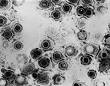 Herpes simplex virus - Wikipedia, the free encyclopedia