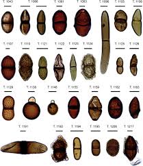 Attēlu rezultāti vaicājumam “Rosellinia desmazieri spores”