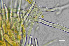 Attēlu rezultāti vaicājumam “Octosporella jungermanniarum”
