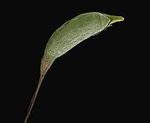 Attēlu rezultāti vaicājumam “Trichia ambigua spores”