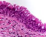 columnar <b>epithelium</b>.JPEG