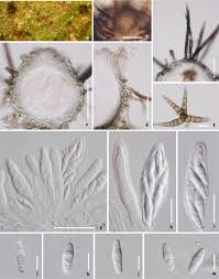 Attēlu rezultāti vaicājumam “Amaurochaete fusiformis spores”