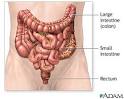 Colon cancer - series - Normal anatomy