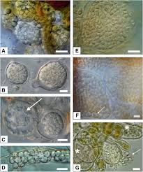 Attēlu rezultāti vaicājumam “Symphytocarpus impexus plasmodium”