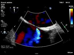 Image result for F C Bulwer